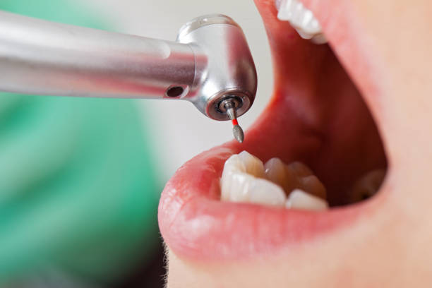 Best Weekend Emergency Dentist in Monticello, FL